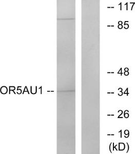 Western blot analysis of lysates from Jurkat cells using Anti-OR5AU1 Antibody. The right hand lane represents a negative control, where the antibody is blocked by the immunising peptide