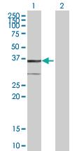 Anti-BDH1 Mouse Polyclonal Antibody