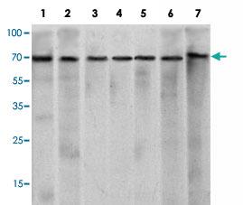 Anti-CHD3 Mouse Monoclonal Antibody [clone: 2G4]