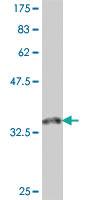 Anti-TRIM6 Mouse Polyclonal Antibody