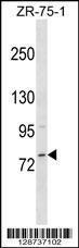 Anti-MICALCL Rabbit Polyclonal Antibody (AP (Alkaline Phosphatase))