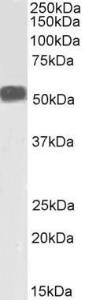 Anti-Desmin Antibody (A84626) (1 µg/ml) staining of Human Skeletal Muscle lysate (35 µg protein in RIPA buffer). Detected by chemiluminescence