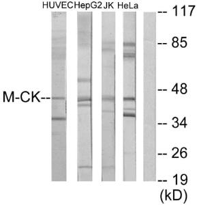 Anti-Creatine Kinase MM Rabbit Polyclonal Antibody