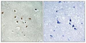 Immunohistochemical analysis of paraffin-embedded human brain using Anti-KAD6 Antibody 1:100 (4°C overnight) The right hand panel represents a negative control, where the antibody was pre-incubated with the immunising peptide