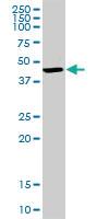 Anti-BDH1 Rabbit Polyclonal Antibody