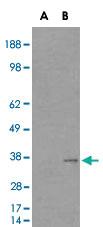 Anti-HAVCR2 Goat Polyclonal Antibody