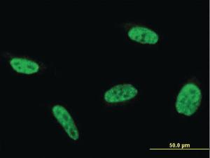 Anti-RABL6 Mouse Monoclonal Antibody [clone: 2E11-1F10]