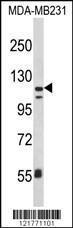 Anti-ITGAX Rabbit Polyclonal Antibody (AP (Alkaline Phosphatase))