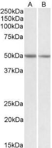 Anti-GNAS Antibody (A83016) (0.1 µg/ml) staining of Mouse Brain (A) and Rat Brain (B) lysates (35 µg protein in RIPA buffer). Primary incubation was 1 hour. Detected by chemiluminescence