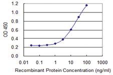 Anti-TSC22D3 Mouse Monoclonal Antibody [clone: 2B2]