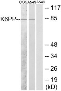 Western blot analysis of lysates from A549 and COS7 cells using Anti-K6PP Antibody. The right hand lane represents a negative control, where the antibody is blocked by the immunising peptide.