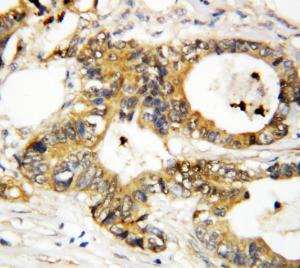 Anti-Annexin A3 Rabbit Polyclonal Antibody