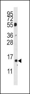 Anti-CDA Rabbit Polyclonal Antibody