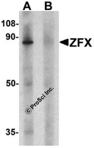 Western blot analysis of ZFX human small intestine tissue lysate with ZFX antibody at 1 &#956;g/ml in (A) the absence and (B) the presence of blocking peptide.