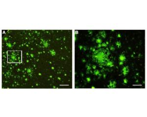 Labelling of amyloid plaques (green) in paraffin-processed cortex from a 1 year old APP/PSI mouse model of AD