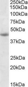 Anti-GNAS Antibody (A83016) (1 µg/ml) staining of Jurkat lysate (35 µg protein in RIPA buffer). Primary incubation was 1 hour. Detected by chemiluminescence