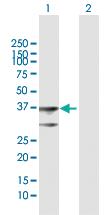 Anti-BDH1 Rabbit Polyclonal Antibody