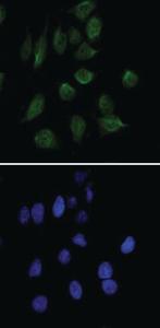 Anti-CHD3 Mouse Monoclonal Antibody [clone: 2G4]