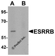 Western blot analysis of ESRRB in human heart tissue lysate with ESRRB antibody at 1 &#956;g/mL in (A) the absence and (B) the presence of blocking peptide.