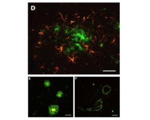 Labelling of amyloid plaques (green) in paraffin-processed cortex from a 1 year old APP/PSI mouse model of AD