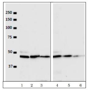 Anti-VRK1 antibody