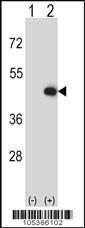 Anti-CKMT2 Rabbit Polyclonal Antibody (HRP (Horseradish Peroxidase))