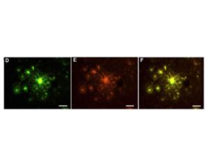 Plaques (green) within the CA-1 region of the hippocampus (D), co-stained with A?x-40/42 MOAB-2 antibody, BSENM-1586-100 (E). F: merged image  Ref: Curr. Alzheimer Res., 2019, Vol. 16, No. 7 583, Figure 4.