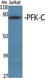 Western blot analysis of various cells using Anti-K6PP Antibody