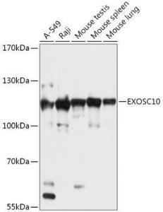 Western blot analysis of extracts of various cell lines, using Anti-EXOSC10/RRP6 Antibody (A309007) at 1:1,000 dilution The secondary antibody was Goat Anti-Rabbit IgG H&L Antibody (HRP) at 1:10,000 dilution Lysates/proteins were present at 25 µg per lane