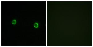 Immunofluorescence analysis of LOVO cells using Anti-OR5AS1 Antibody. The right hand panel represents a negative control, where the antibody was pre-incubated with the immunising peptide