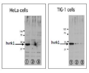 Anti-VRK1 antibody