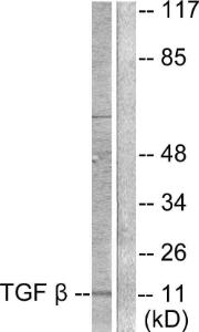 Anti-TGF beta 3 Rabbit Polyclonal Antibody