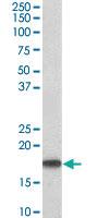 Anti-STMN1 Goat Polyclonal Antibody