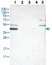 Anti-SLCO2B1 Rabbit Polyclonal Antibody