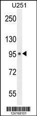 Anti-MICALL1 Rabbit Polyclonal Antibody (APC (Allophycocyanin))