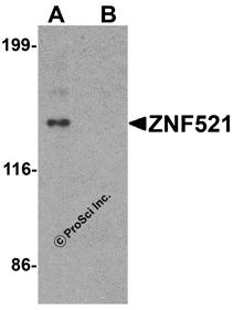 Western blot analysis of ZNF521 in HeLa cell lysate with ZNF521 antibody at 1 &#956;g/ml in (A) the absence and (B) the presence of blocking peptide.