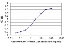 Anti-TAOK3 Mouse Monoclonal Antibody [clone: 3D11]