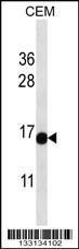 Anti-PRR15L Rabbit Polyclonal Antibody (HRP (Horseradish Peroxidase))