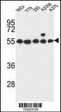 Anti-GPR180 Rabbit Polyclonal Antibody (HRP (Horseradish Peroxidase))