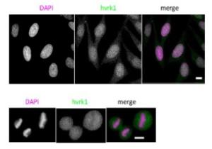 Anti-VRK1 antibody