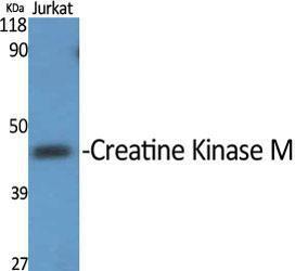 Anti-Creatine Kinase MM Rabbit Polyclonal Antibody