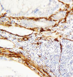 Anti-Caveolin-1 Rabbit Polyclonal Antibody