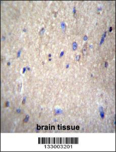 Anti-NAE1 Rabbit Polyclonal Antibody (FITC (Fluorescein Isothiocyanate))