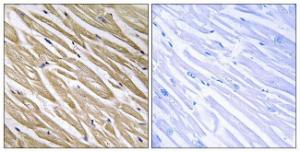 Immunohistochemical analysis of paraffin-embedded human heart tissue using Anti-C5orf13 Antibody. The right hand panel represents a negative control, where the antibody was pre-incubated with the immunising peptide.