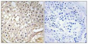 Immunohistochemical analysis of paraffin-embedded human testis using Anti-K6PP Antibody 1:100 (4°C overnight). The right hand panel represents a negative control, where the antibody was pre-incubated with the immunising peptide.