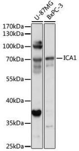 Western blot analysis of extracts of various cell lines, using Anti-ICA69 Antibody (A307772) at 1:1,000 dilution. The secondary antibody was Goat Anti-Rabbit IgG H&L Antibody (HRP) at 1:10,000 dilution.