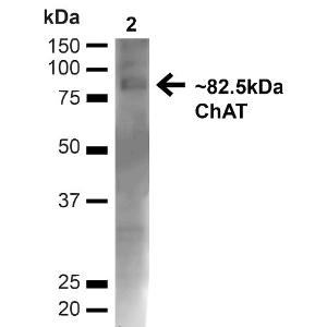 Western blot analysis of mouse brain showing detection of ~825kDa Choline Acetyltransferase protein using Anti-Choline Acetyltransferase Antibody (A304944)