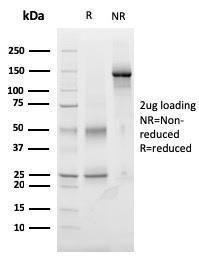 Antibody anti-TIGIT TIGIT3017 BSA 100 µg