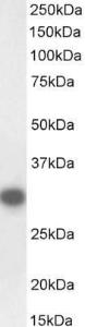 Anti-CTDSP1 Antibody (A83020/Biotin) (0.1 µg/ml) staining of Mouse Testis lysate (35 µg protein in RIPA buffer), exactly mirroring its parental non-biotinylated product. Primary incubation was 1 hour