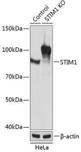 Western blot analysis of extracts from normal (control) and STIM1 knockout (KO) HeLa cells, using Anti-Stromal interaction molecule 1 Antibody (A309008) at 1:1000 dilution